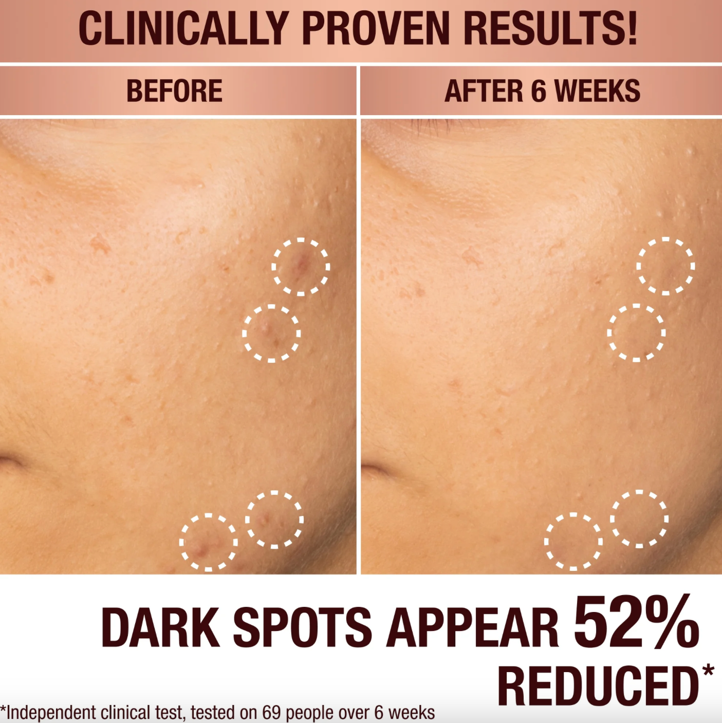 Серум проти темних плям Dark Spots Correcting Radiance Recovery