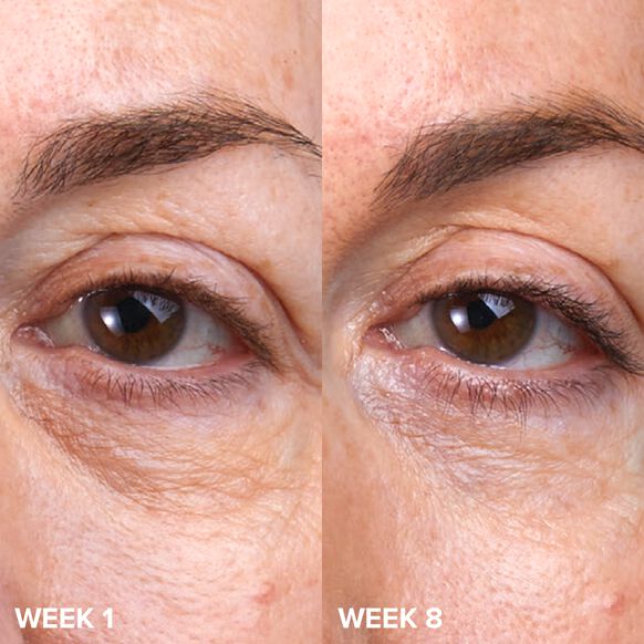 Крем для зони навколо очей C5 Super Boost Eye Cream