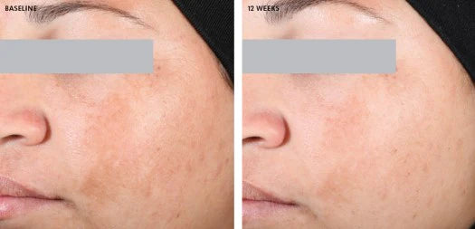 Серум проти пігментації Discoloration Defense Serum