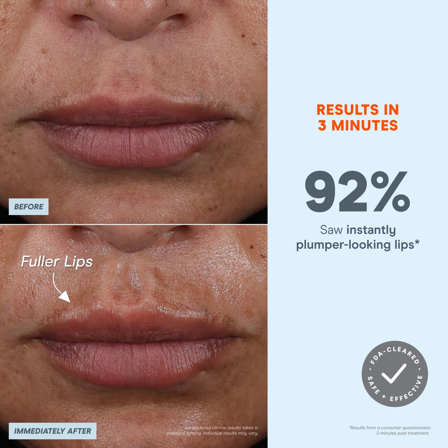 Мікроструми NuFACE FIX Microwand