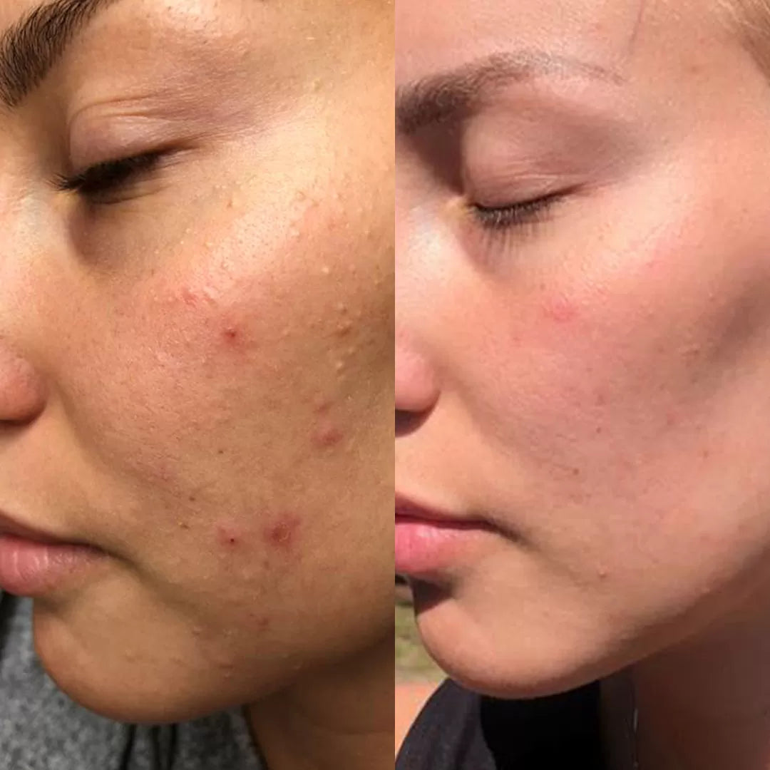 Тоник для лица с 2% салициловой кислотой Skin Perfecting 2% BHA Liquid Exfoliant