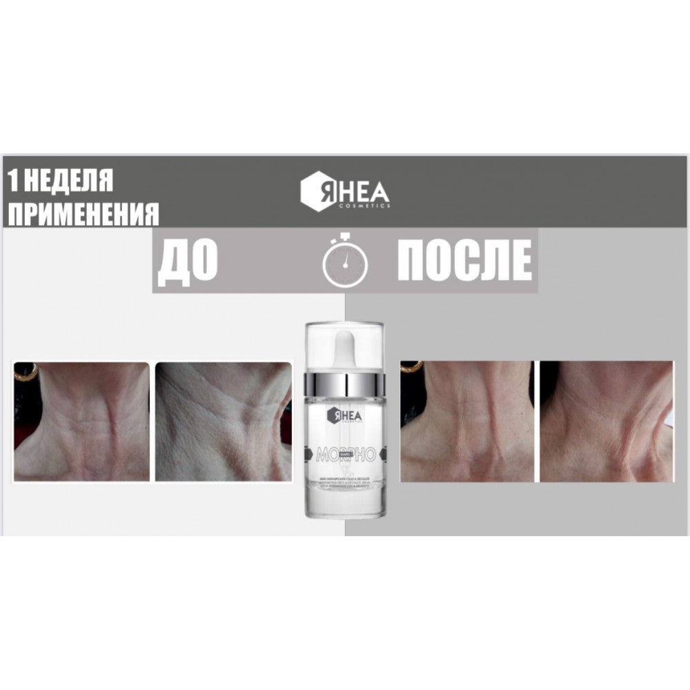 Ремоделюючий серум для шкіри шиї та декольте Morphoshapes 1