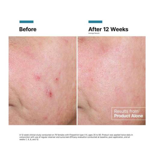 Крем для регенерації шкіри Advanced RGN-6 Skinceuticals