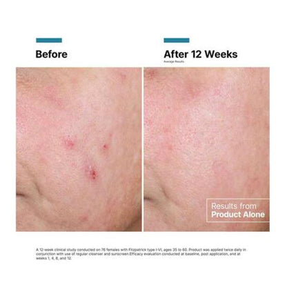 Крем для регенерації шкіри Advanced RGN-6 Skinceuticals