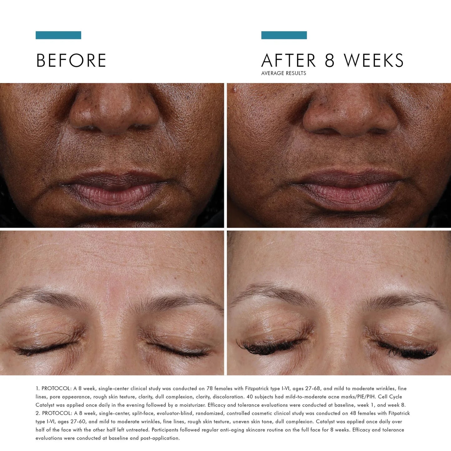 Ексфоліююча сироватка проти старіння Cell Cycle Catalyst Skinceuticals