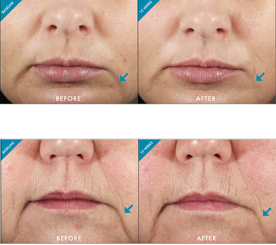Кремова емульсія Anti Age Metacell Renewal B3 Skinceuticals
