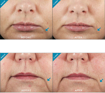 Кремова емульсія Anti Age Metacell Renewal B3 Skinceuticals